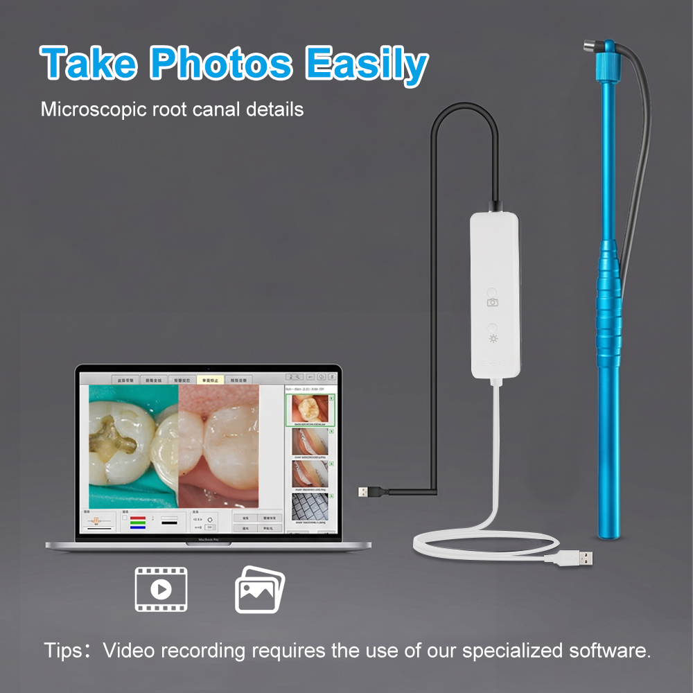 5MPマイクロ口腔内カメラ、歯科用口腔内カメラ、HD USB - Mini Electronics Gadgets のレビューと価格